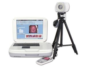Wholesale digital video recorder: YKD-3004 Portable Digital Colposcope