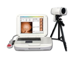 Wholesale zoom camera: YKD-1004 Portable Infrared Breast Examination Equipment