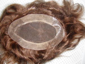 Frontals