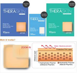 Hydrocolloid Dressing